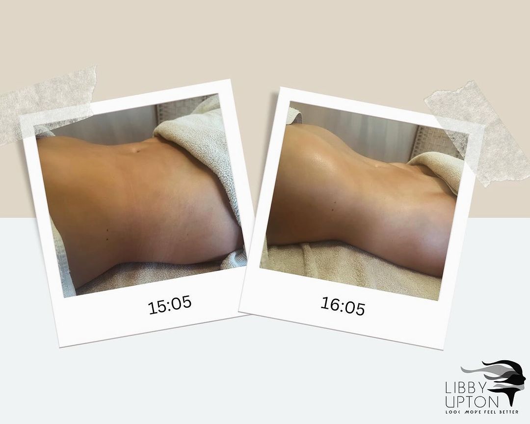 See what a difference an hour (and some Lymphatic Magic) can make… So many m...
