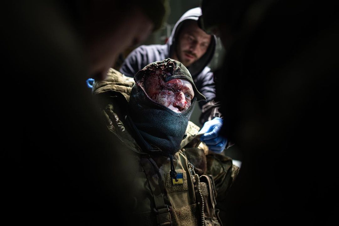 Two faces of the Russian Ukrainian War.