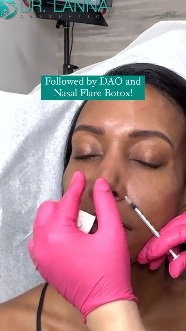 Drink E-Z - Lip Augmentation Post-Care Tip: Avoid drinking through a straw.⁣  Why?⁣ Drinking out of straws post-injection can definitely ruin the shape  of your new lips when creating that negative pressure