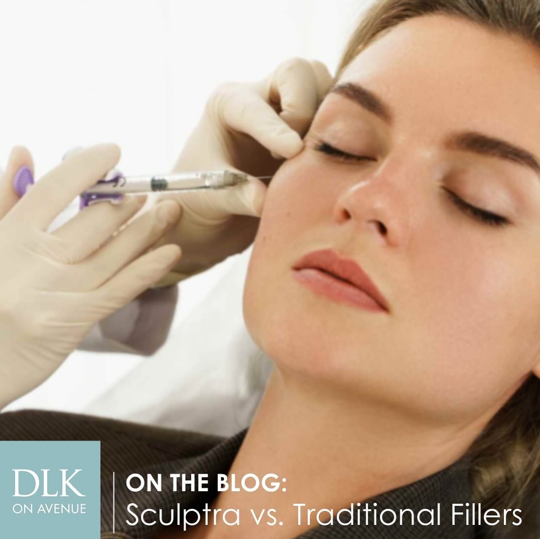 Discover the difference between Sculptra and traditional fillers in our lates...